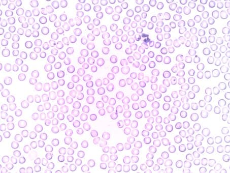 Curso de Técnico en Hematología